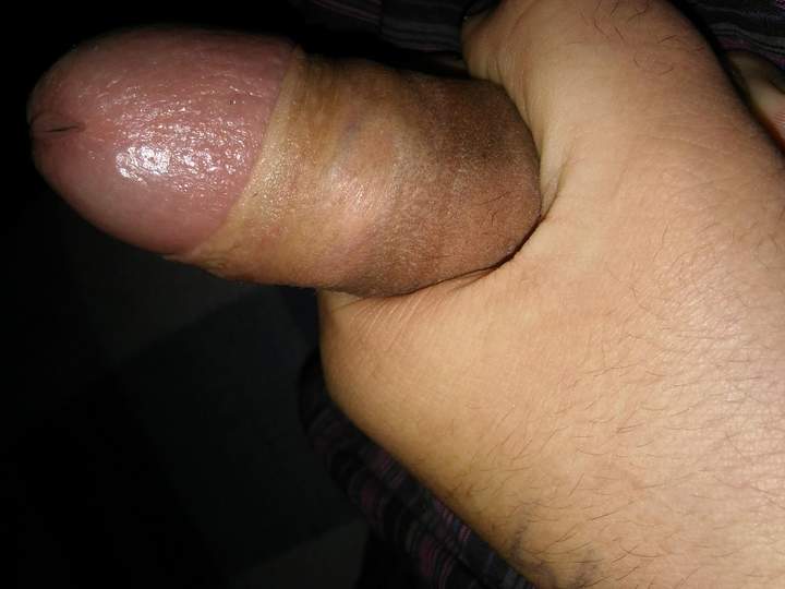 Cock head peaking out, brilliant 