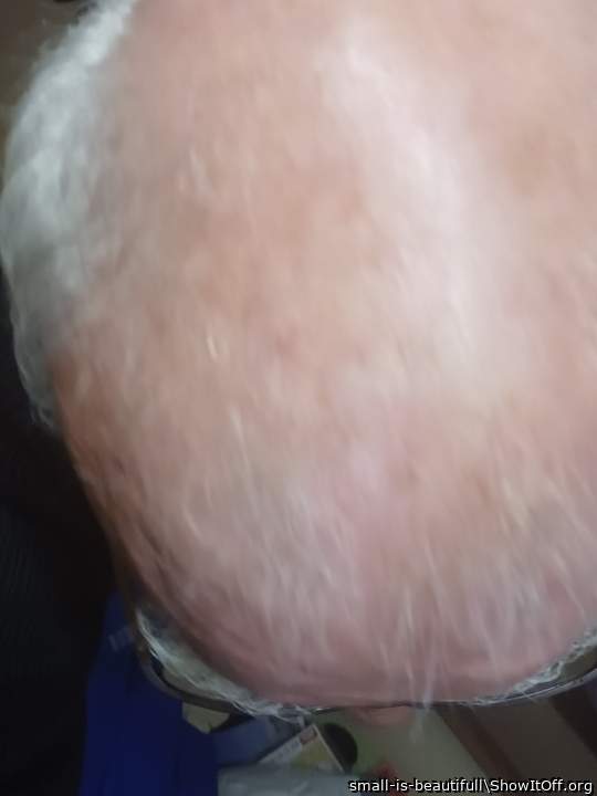 ... and the bald on my head &#128521;