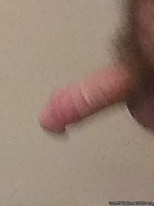Photo of a middle leg from Irish7X5