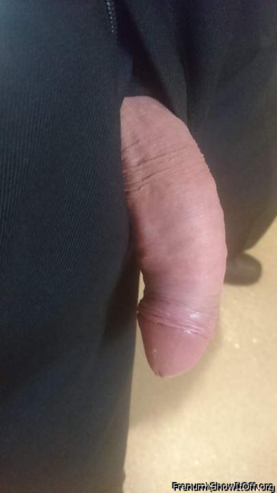 Foreskin retracted