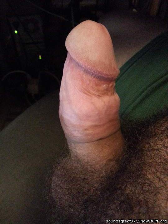 Foreskin rolled back over itself, no ring, erect