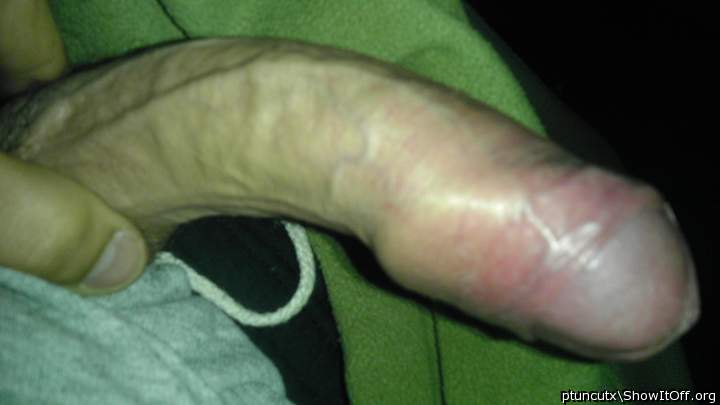 Photo of a penile from ptuncutx