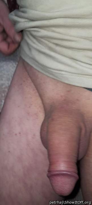 my dick normal