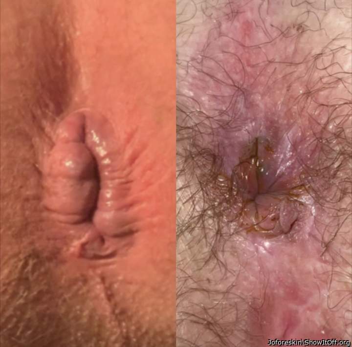 My anus and my wife�s anus�