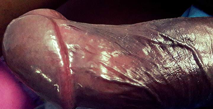 Photo of a sausage from judo