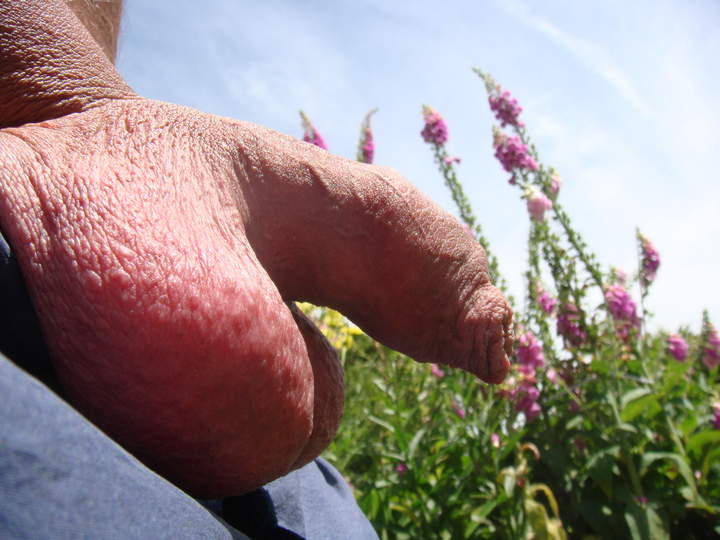 Photo of a middle leg from sivad666