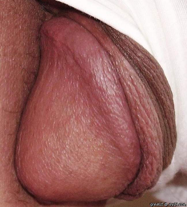 Peeking