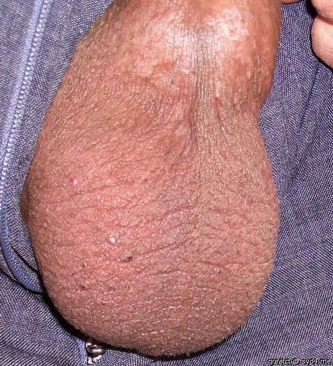 Testicles Photo from greatct
