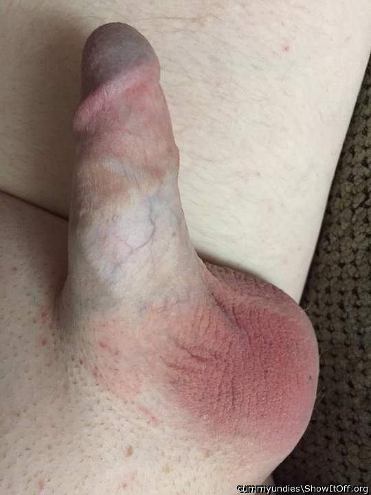 Photo of a penis from cummyundies
