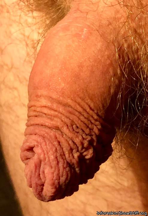 My foreskin