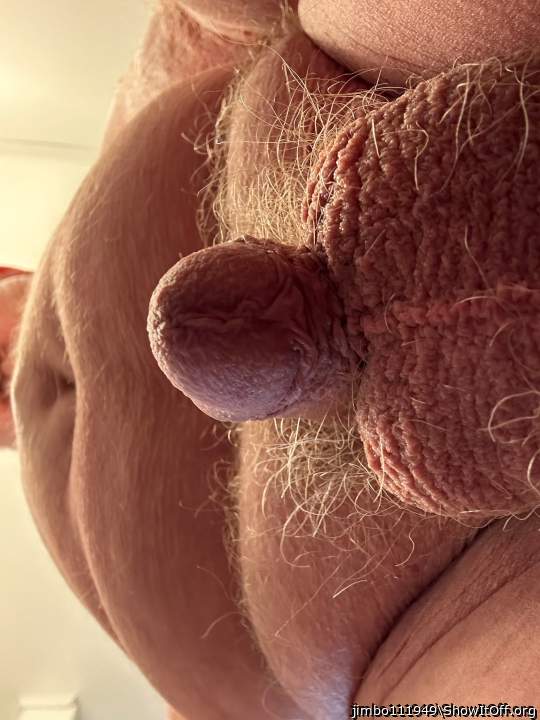 Photo of a penile from jimbo111949
