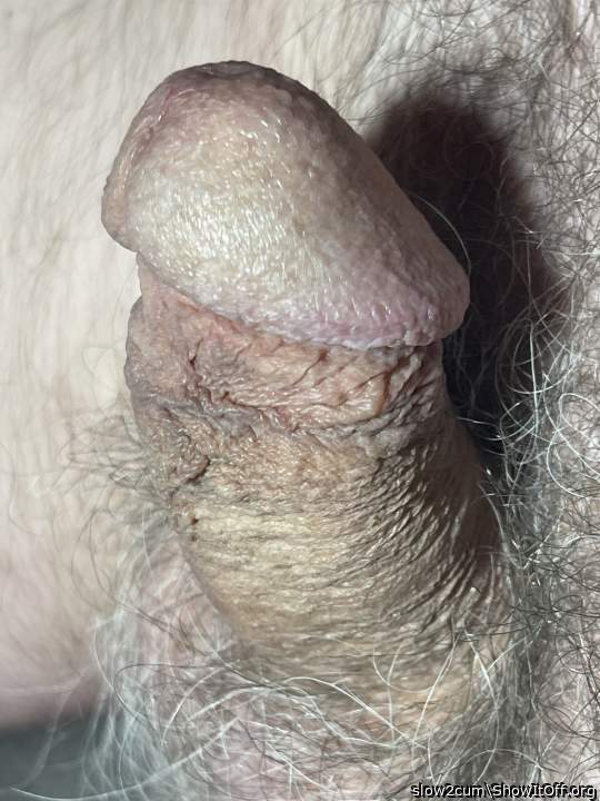 Photo of a one-eyed monster from slow2cum