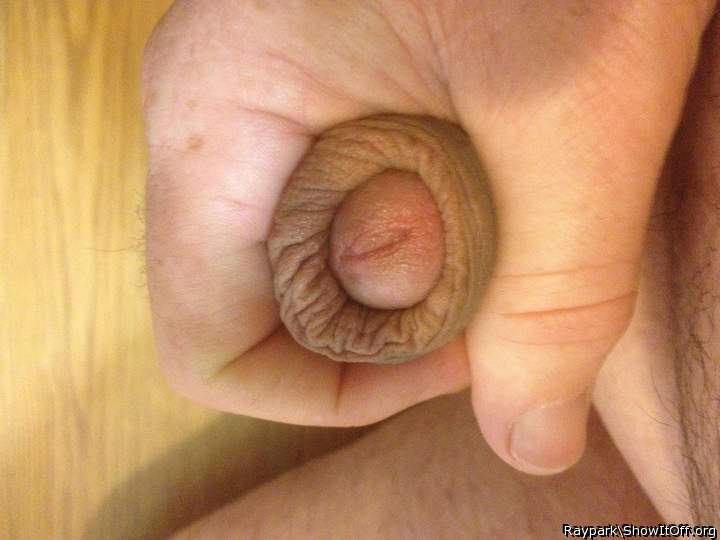 Restored foreskin