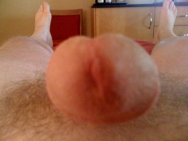 Photo of a prick from arctic11
