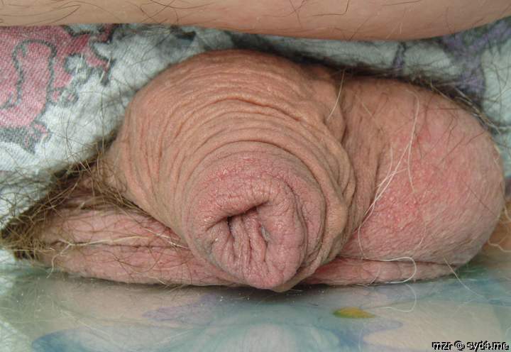 Closeup foreskin