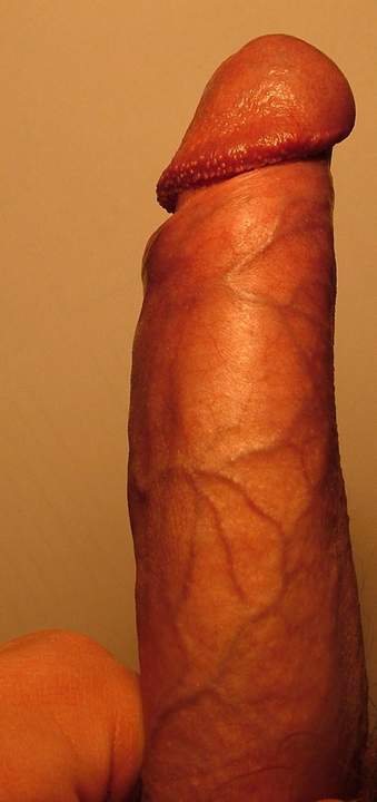 Photo of a wiener from vtbartje