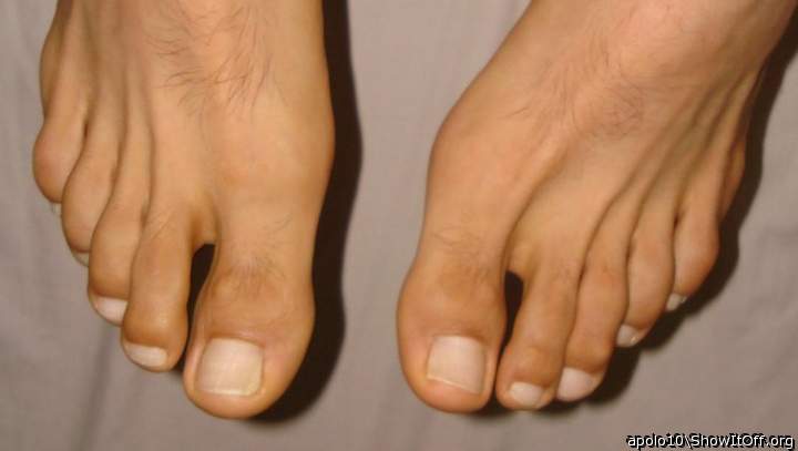 apolo10 - Toes