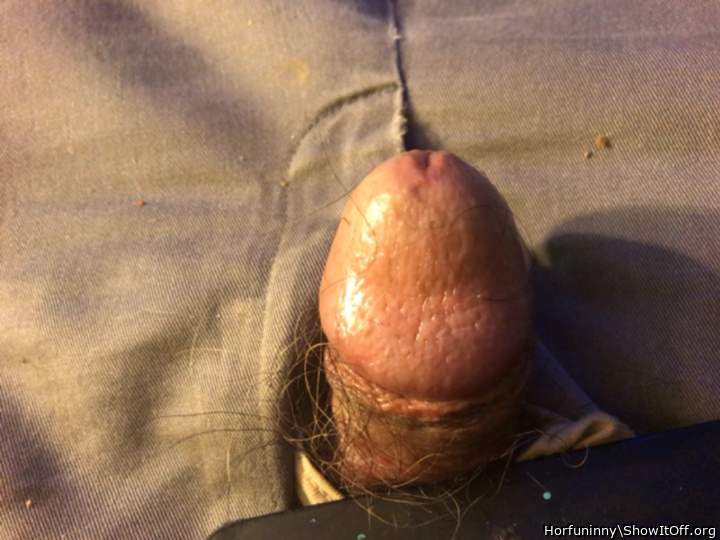 Photo of a penile from Horfuninny