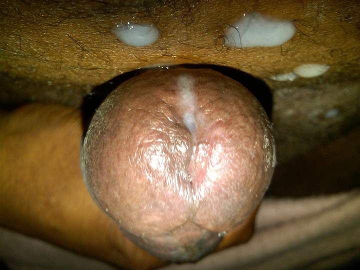 Photo of a prick from GaryMPLS72