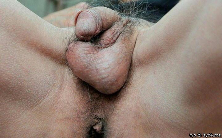Photo of a penile from ryo