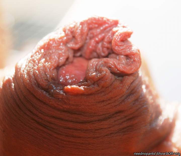 Photo of a prick from neednopants