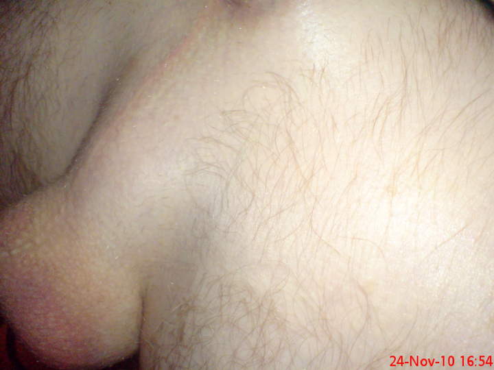 Testicles Photo from mack101