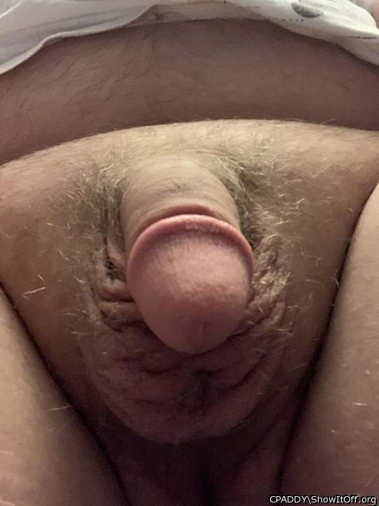 My Circumcised Dick-Do you like it?