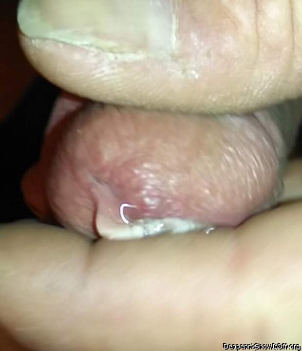 Photo of a short leg from Denpenn