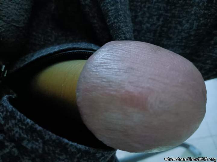 Photo of a penile from edwardren