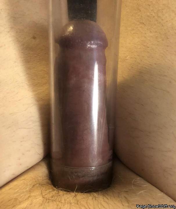 Suctioned