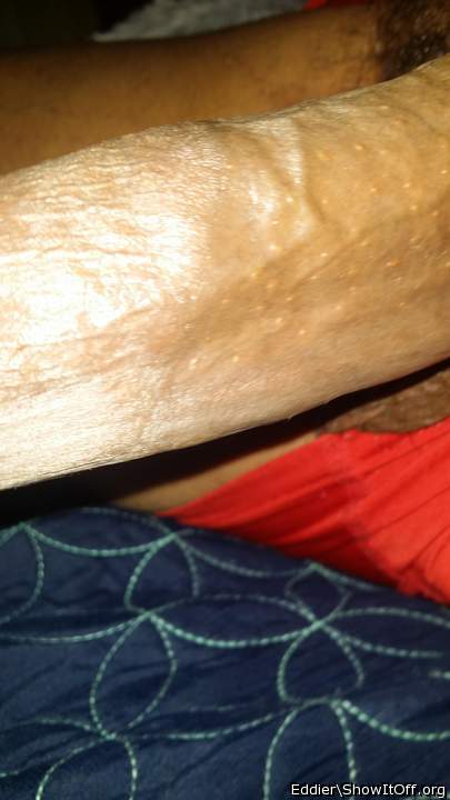 Photo of a penile from eddier