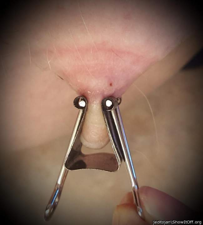 Nipple Clamp