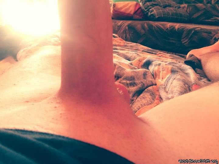 Photo of a short leg from elcid
