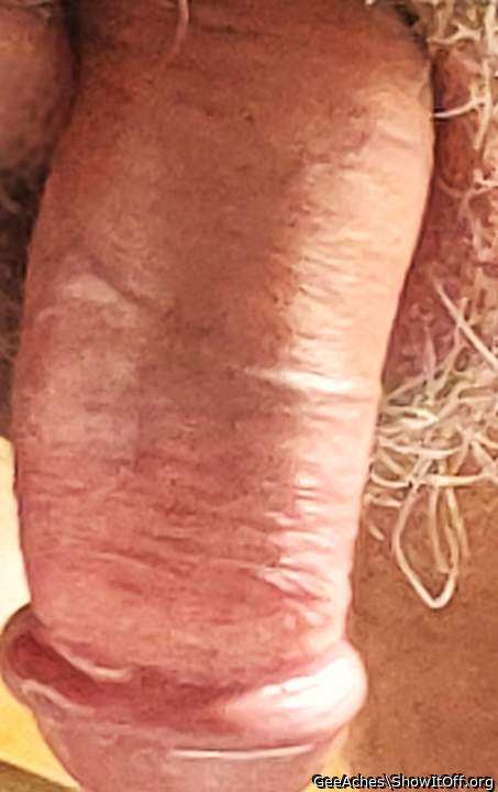 Photo of a penile from GeeAches