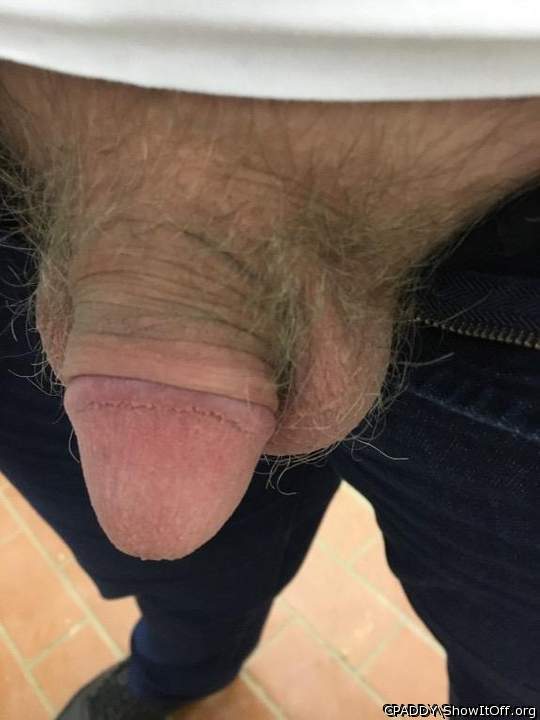 My Circumcised Dick-Do you like it?
