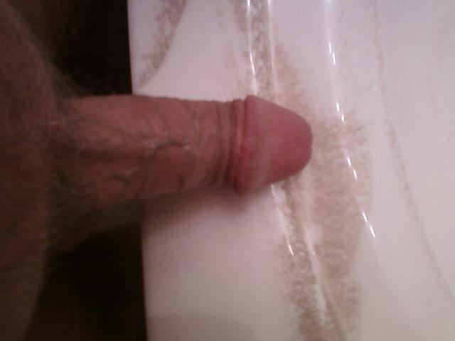 Photo of a penile from iduda2003
