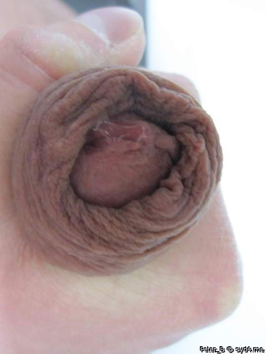 foreskin