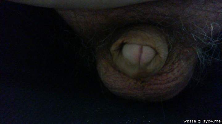 Photo of a prick from wasse
