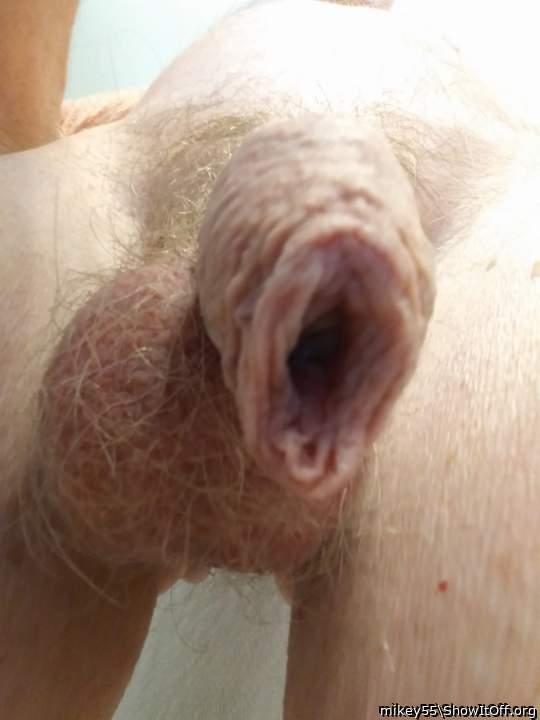 Foreskin