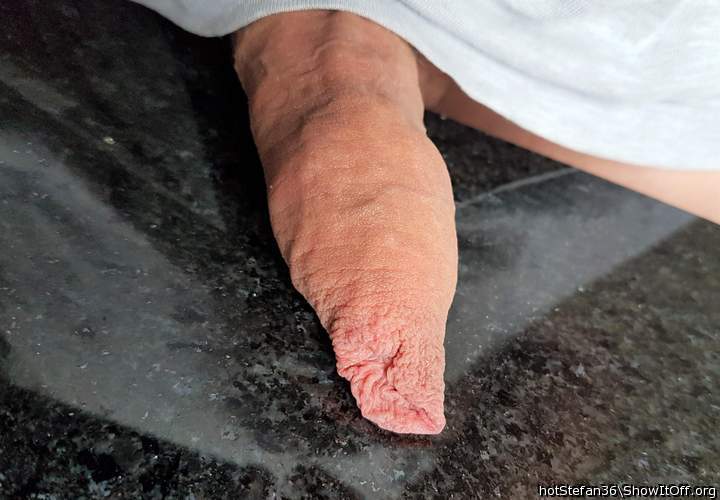 Looks like a foreskin sushi roll....YUM