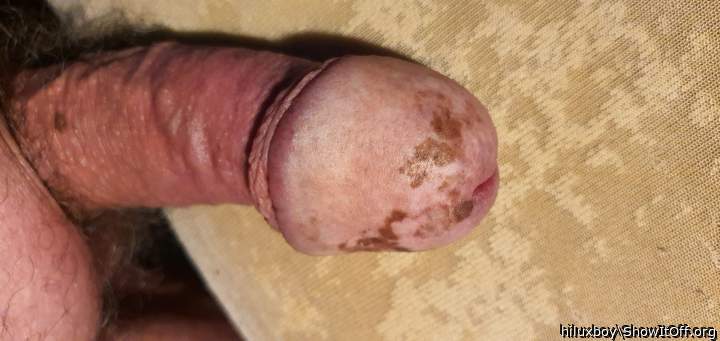 Photo of a bald-headed mouse from hiluxboy