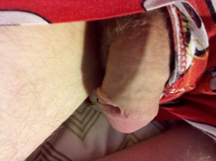 Photo of a middle leg from skinb