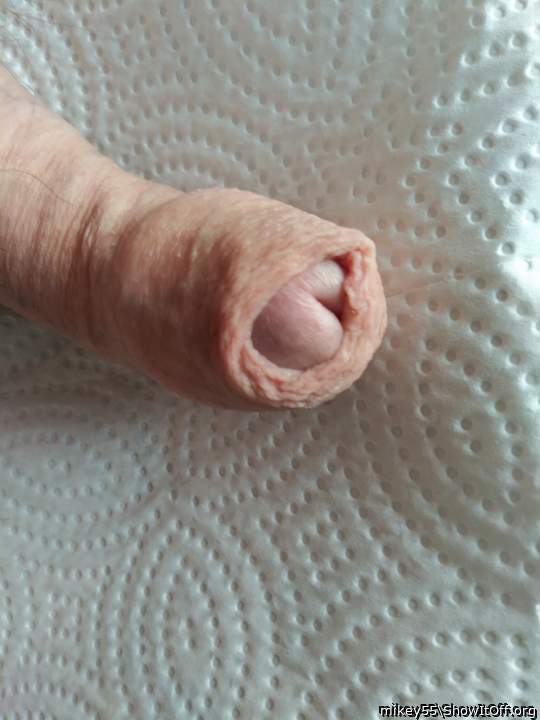 Foreskin