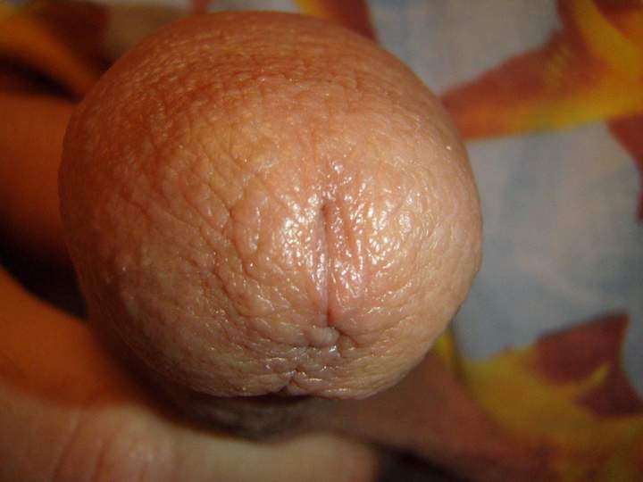 Photo of a middle leg from lilsoftee