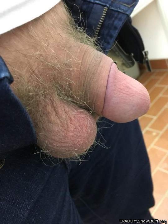 My Circumcised Dick-Do you like it?