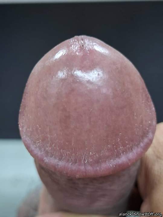 Photo of a penile from alanck