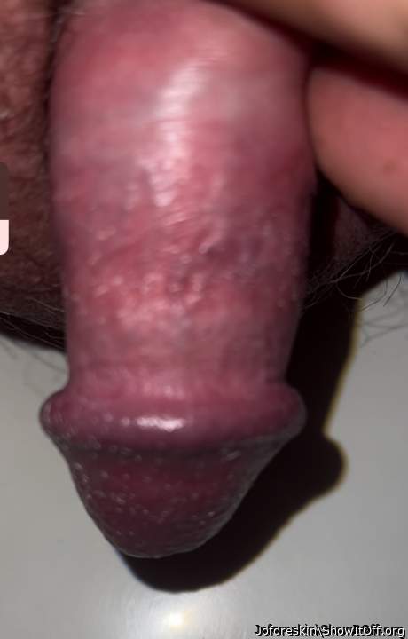 Photo of a prick from Joforeskin