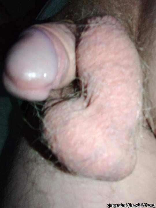 Testicles Photo from gingerzim