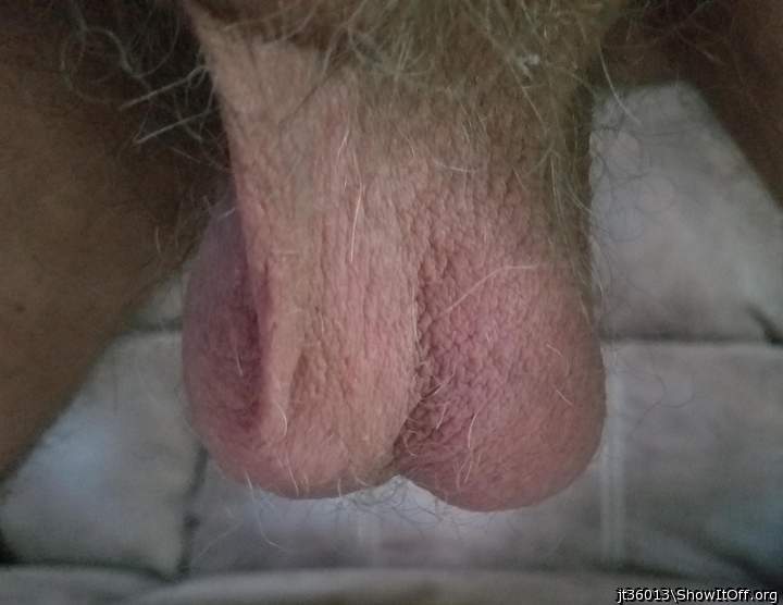   beautiful hairy sack
