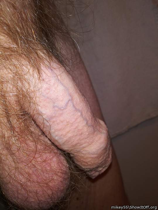 Foreskin